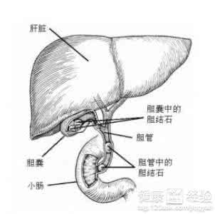 中医可以治愈胆结石吗 【转载】治愈胆结石可以被“吃掉”