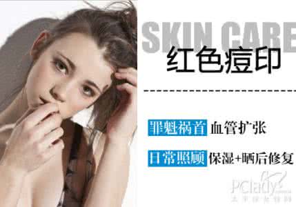 口碑最好的补水爽肤水 口碑爽肤水 好用不贵才是硬道理