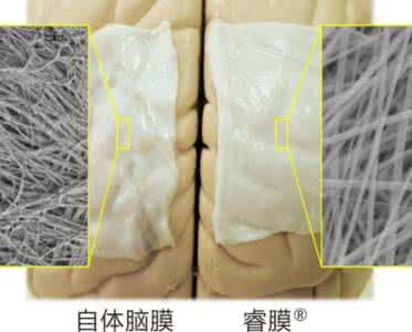 乳房生物反应器 国产3D生物打印乳房技术将面世