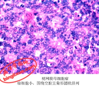 软组织肿块是不是肿瘤 软组织肿块是不是肿瘤 肛门是不是皮肤软组织？