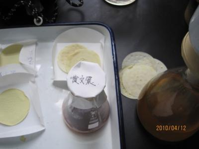 治疗肾结石的偏方 得了肾结石怎么办？老家的爷爷的土偏方治疗肾结石效果很好