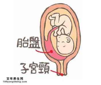 如何预防胎盘早剥 准妈妈如何预防胎盘早剥