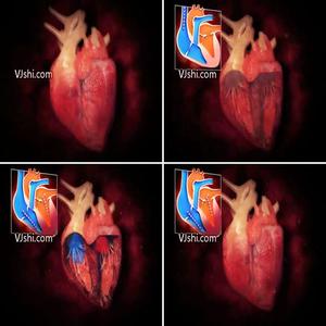 心脏搏动的机理 心脏自我跳动的机理