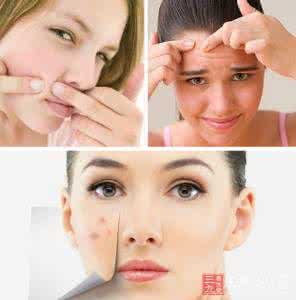 如何祛痘痘痘 祛痘新吃法:去痘痘健康饮食