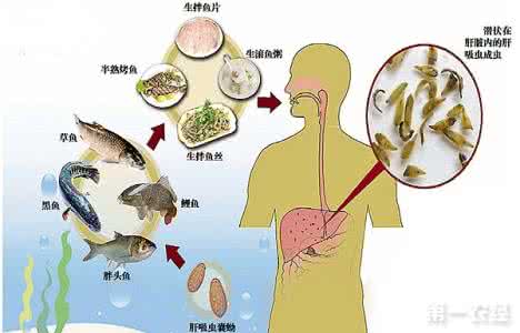 吃淡水鱼生,会增添肝癌的风险