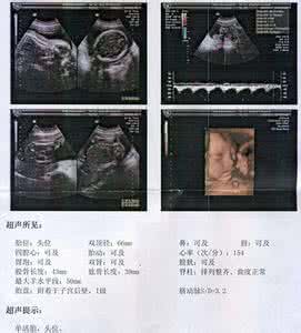 孕晚期怀男宝胎动特征 怀男宝最明显的特征 怀男孩女孩的区别在哪里