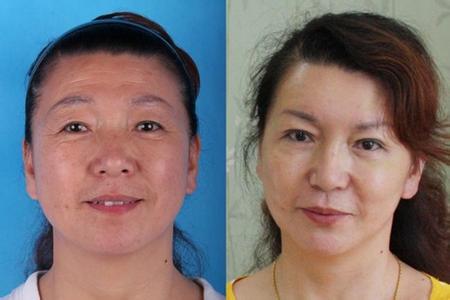 如何防治老年斑 香港人日常怎样生活的 日常生活中怎样防治老年斑