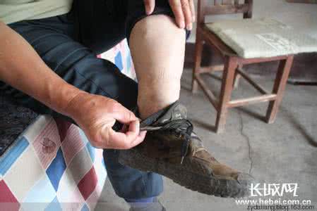 老寒腿 关节炎 根治老寒腿(关节炎）的土秘方