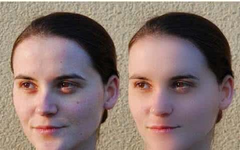 皮肤色斑 色斑痘痕皮肤怎样化妆