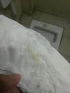 孕晚期分泌物增多发黄 孕晚期分泌物发黄 孕晚期分泌物发黄是什么原因呢?