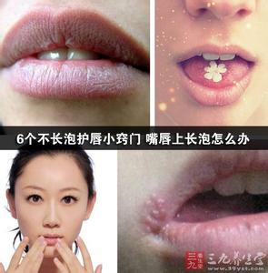 嘴唇容易长泡 春季嘴唇容易长泡怎么办