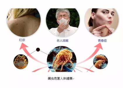 棉被如何清除螨虫 ? 教你快速去除棉被上的百万螨虫！非常实用！