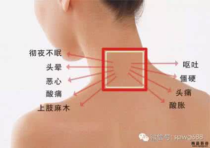 颈椎病有啥症状 颈椎病的症状有啥