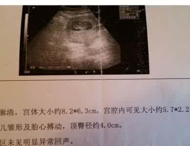 现在做四维彩超多少钱 现在来例假能做彩超吗?