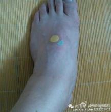 冠心病后背疼怎么缓解 “冠心病”的妙穴！立即缓解心前区不适，有奇效