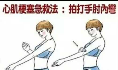 心梗发作 心梗发作的症状 怀疑心梗发作，怎么做才不帮倒忙？
