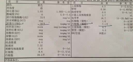 尿蛋白的治疗方法 尿蛋白的治疗方法 怎样才能治尿蛋白