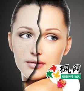 抗皱祛斑 抗皱又祛斑 教你低成本食醋美容法(组图)