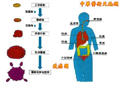 免疫系统紊乱的原因 免疫系统疾病 引起免疫系统疾病的原因