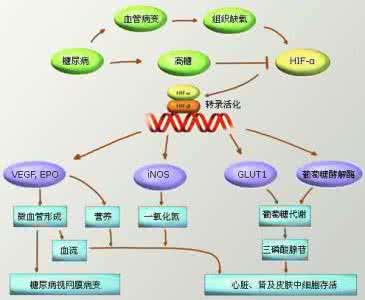 糖尿病相关知识 糖尿病的疾病相关知识 糖尿病的疾病分类