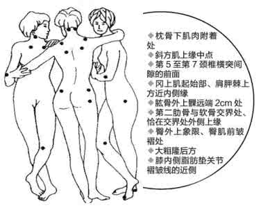 跑步时小腿肌肉酸痛 你们媒体千万要注意了 肌肉痛 肌肉痛时你千万要注意这个