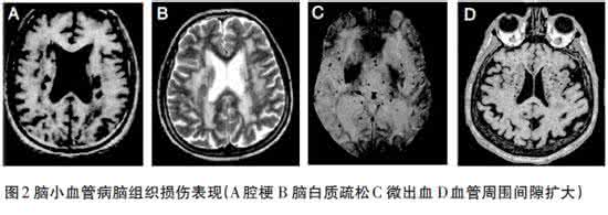 声带受损挂什么科 组织受损挂什么科？