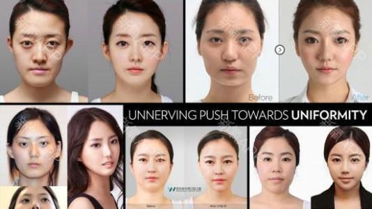 韩国整容节目美人照片 去韩国进行整容手术未康复的女性照片 韩国整容