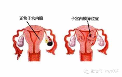 现场管理七大因素 七大因素成痛经幕后黑手