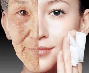 面部悬吊除皱术 面部悬吊除皱术 面部悬吊除皱