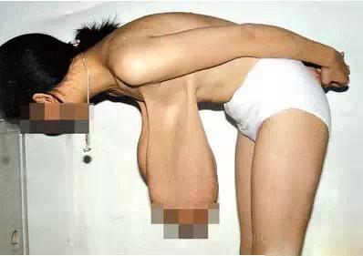 乳房下垂的解决方法 解决乳房下垂的神奇方法，99%的恢复度！你竟然还不知道？