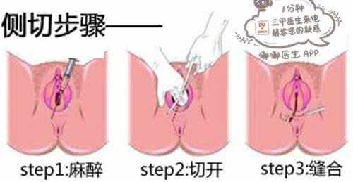 顺产胯骨会变宽吗 顺产胯骨会变宽吗 顺产以后胯骨为什么疼？