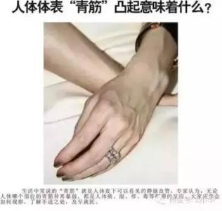 手上的青筋是什么血管 青筋其实不是筋,而是受阻的血管