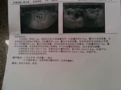 孕囊发育过程 孕囊是怎么形成的？孕囊发育过程