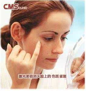 激光祛斑 激光祛斑 激光祛斑不宜在夏季进行