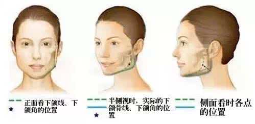 瘦咬肌最好的方法 瘦咬肌最好的方法 怎么瘦咬肌