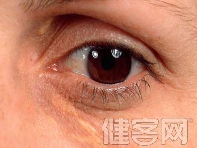 从眼睛看身体疾病图解 教你从五眼睛分泌物状况 辨别身体疾病