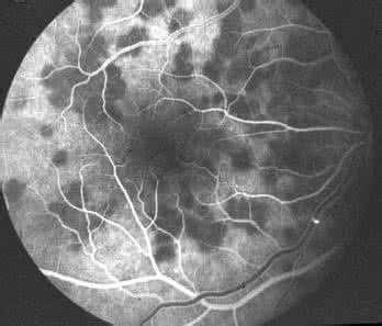 造影费用多少 照影