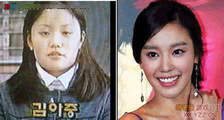 韩国明星整容失败对比 韩国整容失败的明星 由王贝之死盘点整容失败的明星