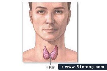 甲状腺肿大症状与治疗 甲状腺肿大的症状 甲状腺肿大是什么 甲状腺肿大症状及治疗 甲状腺肿大的症状