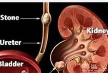 尿道刺痛自己会好吗 尿道刺痛自己会好吗 尿道刺痛自己会好吗 要看病因