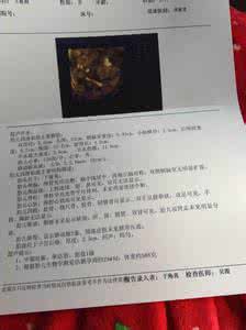 胎儿性别最准鉴定方法 胎儿性别最准鉴定方法 胎儿性别鉴定的方法有哪些