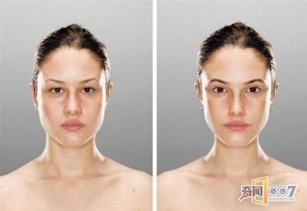 下颚疼是怎么回事 右边脸下颚疼怎么回事?