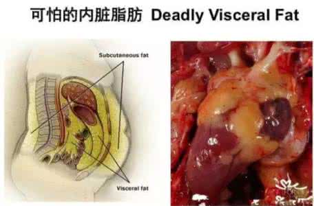 身体内脏 冬季身体出现寿斑 是内脏老化的信号
