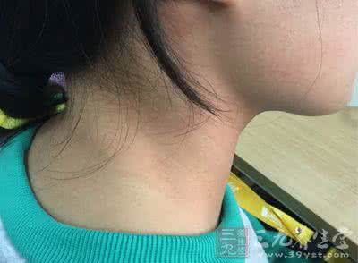 那些因素会导致不孕 腋下肿块 这些因素会导致腋下肿块