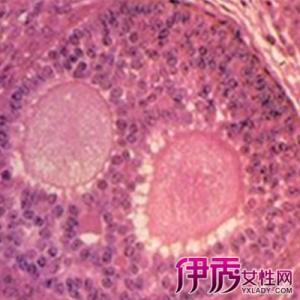 卵泡破裂后多久同房 卵泡破裂后多久同房易怀孕?