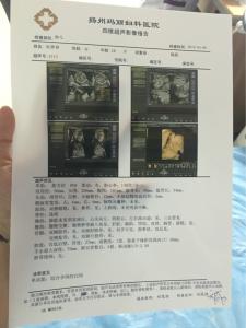 b超和四维彩超区别 四维彩超 系统b超 二胎孕妈心得，B超保不了宝宝平安，四维彩超才行