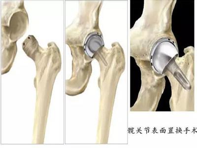 髋关节旋转时动作缓慢 髋关节旋转时动作缓慢 一个动作就能检查身体关节是否健康，赶紧来试试