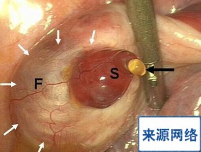 排卵能看到吗 女性排卵自己能看到吗？