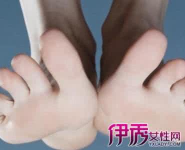 动脉粥样硬化的治疗 动脉粥样硬化的治疗 动脉硬化的治疗 教你如何告别动脉硬化