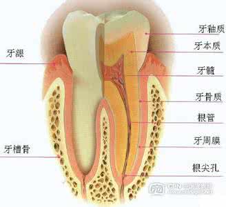 牙坏了不拔会怎么样 坏牙怎么治疗